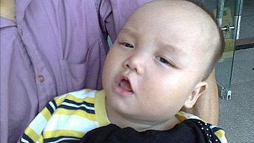 舌头痛吃瓜视频,揭秘舌头痛背后的瓜秘密